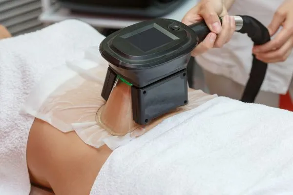 Image of person having fat freezing treatment to help weight gain Tipton