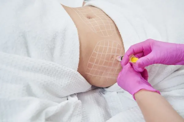 image of fat dissolving injections on love handles to help combat weight gain Tipton