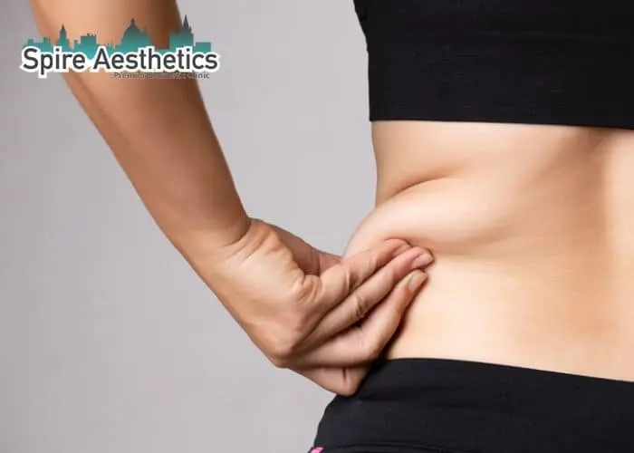 Image of woman pinching fat on their hips Tipton. Fat Freezing treatment 