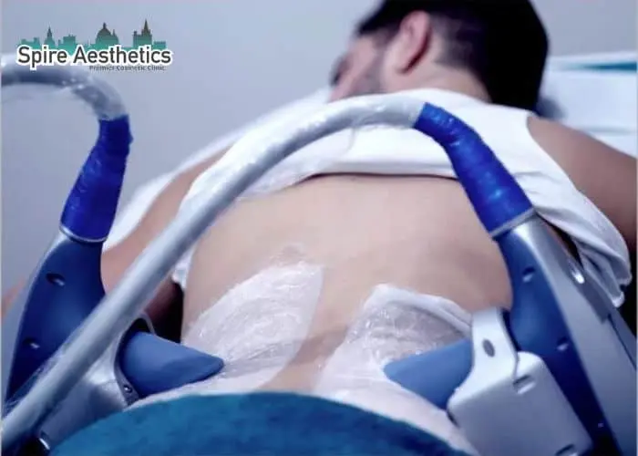 Man having fat freezing treatment done on love handles before a competitions Tipton to create a sculpted look.