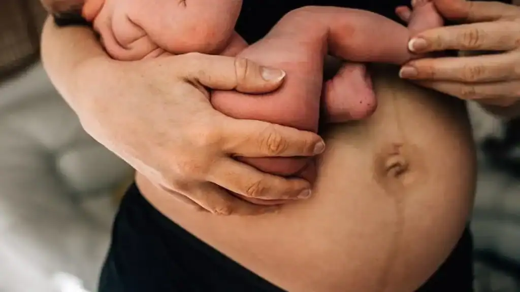 Why Is My Stomach Still Big After Pregnancy Tipton?